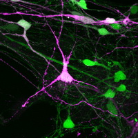 Human embryonic stem cells (hESC) differentiated into cortical neurons (expressing GFP) after 67days in culture using astrocytes as feeder layer. A population of this neurons were transduced with lentivirus and express tdTomato tagged proteins (in magenta)